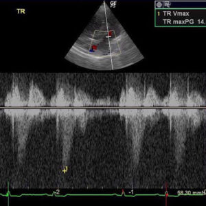 Ultrasound diagnostics to enhance interpretation of disorders and conditions.